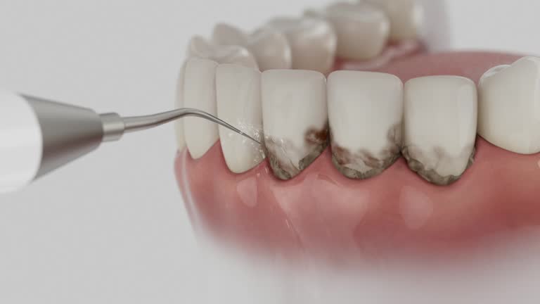 Reliable Emergency Dentist contractor in Middletown, IN by Smile Center Dentistry